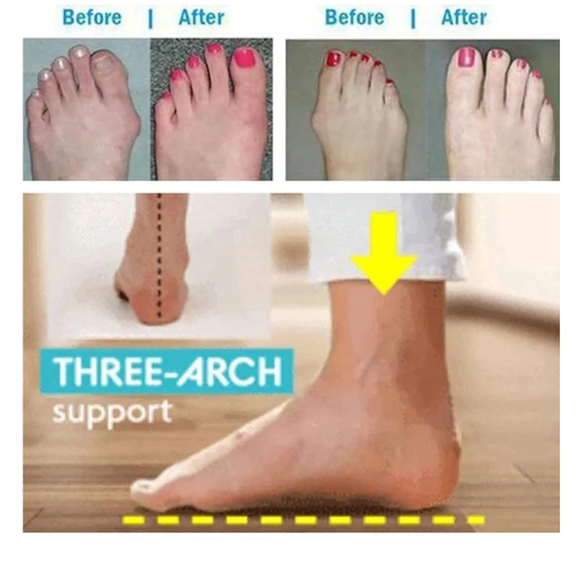 Sandal Foot Correction - Picture 3 of 4